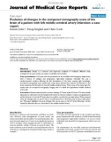 Báo cáo y học: Evolution of changes in the computed tomography scans of the brain of a patient with left middle cerebral artery infarction: a case report