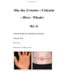 Mày đay (Urtcaire – Urticaria – Hives - Wheals) (Kỳ 2)