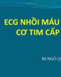 Bài giảng ECG 3: ECG nhồi máu cơ tim cấp - Phần 1