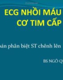 Bài giảng ECG 3: ECG nhồi máu cơ tim cấp - Phần 2