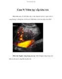 Case 9: Viêm tụy cấp khu trú