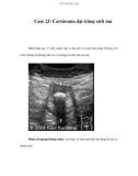 Case 23: Carcinoma đại tràng xích ma