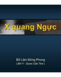 Bài giảng X quang ngực - BS. Lâm Đâm Phong