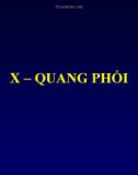 Bài giảng X quang phổi