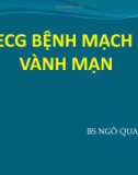 Bài giảng ECG 3: ECG bệnh mạch vành mạn