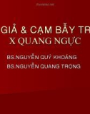 X quang ngực