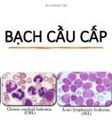 Bài giảng Bạch cầu cấp