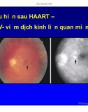 Bài giảng điều trị HIV : Hội chứng phục hồi miễn dịch part 8