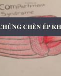 Bài giảng Hội chứng chèn ép khoang