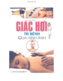 Hướng dẫn Giác hơi trị bệnh qua hình ảnh: Phần 1