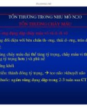 HÌNH ẢNH CẮT LỚP VI TÍNH CHẤN THƯƠNG SỌ NÃO part 9