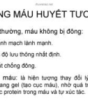 Đông máu huyết tương