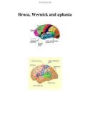 Broca, Wernick and aphasia