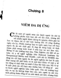 Phòng ngừa và điều trị bệnh dị ứng: Phần 2