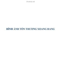 HÌNH ẢNH TỔN THƯƠNG XOANG HANG