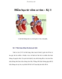 Hiểm họa từ viêm cơ tim – Kỳ I