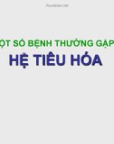 Bài giảng Một số bệnh thường gặp của hệ tiêu hóa