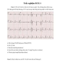 Trắc nghiệm ECG 1