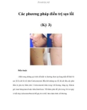 Các phương pháp điều trị sẹo lồi (Kỳ 3)