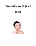 Tìm hiểu sự thật về mụn