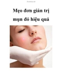 Mẹo đơn giản trị mụn đỏ hiệu quả