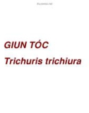 Bài giảng Giun tóc