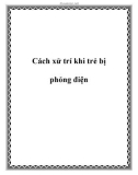 Cách xử trí khi trẻ bị phỏng điện