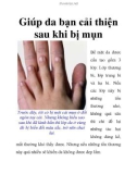 Giúp da bạn cải thiện sau khi bị mụn