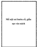 Mổ nội soi bướu cổ, giấu sẹo vào nách