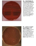 Atlas de poche de microbiologiel - part 8