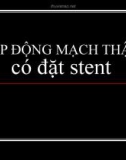 HẸP ĐỘNG MẠCH THẬN