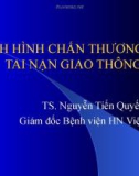 TÌNH HÌNH CHẤN THƯƠNG DO TAI NẠN GIAO THÔNG