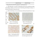 Luận văn : ỨNG DỤNG PHƯƠNG PHÁP IN SITU HYBRIDIZATION ĐỂ CHẨN ĐOÁN MẦM BỆNH WSSV (White Spot Syndrome Virus) TRÊN TÔM SÚ (Penaeus monodon) VÀ TSV (Taura Syndrome Virus) TRÊN TÔM THẺ CHÂN TRẮNG (Penaeus vannamei) part 3