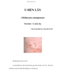 U HẾN LÂY (Molluseum contagiosum)