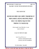 Luận án tiến sĩ Y học: Đánh giá hiệu quả điều trị bệnh lý Moyamoya bằng phương pháp bắc cầu động mạch não trong và ngoài sọ