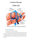 Ung thư tế bào gan ( Phần cuối)