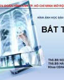 Bài giảng Bất thường phổi - ThS. BS. Nguyễn Việt Hùng