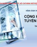 Bài giảng Cộng hưởng từ tuyến mang tai - ThS. BS. Nguyễn Anh Huy