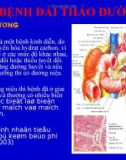 Bài giảng: Bệnh đái tháo đường