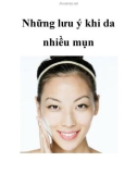 Những lưu ý khi da nhiều mụn