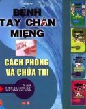 Cách phòng và chữa trị bệnh tay chân miệng: Phần 1