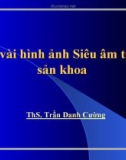 Bài giảng Một vài hình ảnh Siêu âm trong sản khoa - ThS. Trần Danh Cường