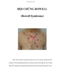 HỘI CHỨNG ROWELL (Rowell Syndrome)