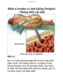 Bệnh u lympho ác tính không Hodgkin - Những điều cần biết