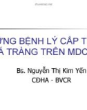 Bài giảng Những bệnh lý cấp tính ở tá tràng trên MDCT - BS. Nguyễn Thị Kim Yến