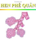 Bài giảng Bệnh hen phế quản