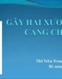 Bài giảng Gãy hai xương cẳng chân - ThS. Trần Trung Dũng