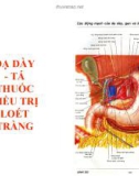 Bài giảng Dược lý học: Dạ dày - Tá: Thuốc điều trị loét tràng