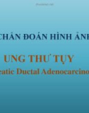 Bài giảng Chẩn đoán hình ảnh ung thư tụy