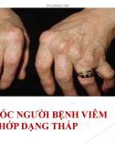 Bài giảng Chăm sóc người bệnh viêm khớp dạng thấp - Đỗ Thị Linh